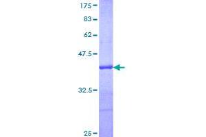 Image no. 1 for Peroxiredoxin 5 (PRDX5) (AA 105-214) protein (GST tag) (ABIN1316161)
