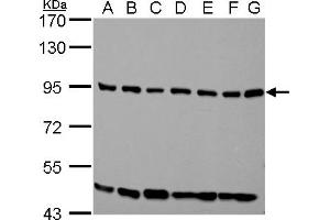 WB Image ELMO1 antibody [C3], C-term detects ELMO1 protein by western blot analysis. (ELMO1 抗体  (C-Term))