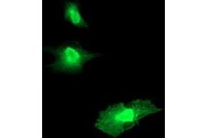 Anti-RGS16 mouse monoclonal antibody (ABIN2455383) immunofluorescent staining of COS7 cells transiently transfected by pCMV6-ENTRY RGS16 (RC202430). (RGS16 抗体)