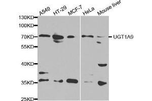 Western blot analysis of extracts of various cell lines, using UGT1A9 antibody. (UGT1A9 抗体  (AA 26-250))