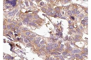 ABIN6267008 at 1/100 staining human Breast tissue sections by IHC-P. (KRT15 抗体)