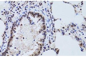 Immunohistochemistry of paraffin-embedded Rat lung using SIRT7 Polyclonal Antibody at dilution of 1:100 (40x lens). (SIRT7 抗体)