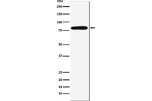 Western Blotting (WB) image for anti-Calpain 2 (CAPN2) antibody (ABIN7606976)