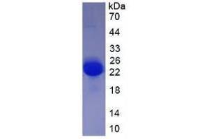 Image no. 2 for Vascular Endothelial Growth Factor A (VEGFA) (AA 27-190) (Active) protein (His tag) (ABIN6239764)