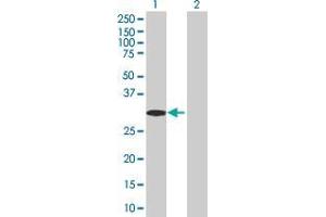 Western Blot analysis of RNF32 expression in transfected 293T cell line ( H00140545-T02 ) by RNF32 MaxPab polyclonal antibody. (RNF32 抗体  (AA 1-256))