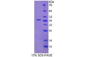 SDS-PAGE analysis of Mouse CAMLG Protein. (CAMLG 蛋白)