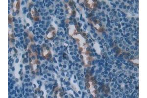Detection of PLS3 in Mouse Kidney Tissue using Polyclonal Antibody to Plastin 3 (PLS3) (Plastin 3 抗体  (AA 5-251))