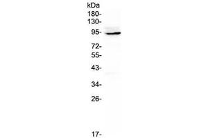 Western blot testing of rat thymus lysate with Ptpn22 antibody at 0. (PTPN22 抗体)