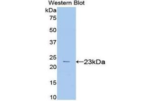 Western blot analysis of the recombinant protein. (VEGFA 抗体  (AA 27-190))