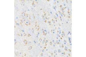 Immunohistochemistry of paraffin-embedded mouse brain using CHIC2 antibody (ABIN6130103, ABIN6138533, ABIN6138534 and ABIN6223980) at dilution of 1:100 (40x lens). (CHIC2 抗体  (AA 1-165))