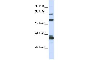 PES1 antibody used at 1 ug/ml to detect target protein. (PES1 抗体)