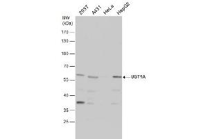 WB Image UGT1A antibody detects UGT1A protein by western blot analysis. (Ugt1 抗体)