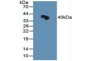 Detection of HSPBP1 in Rat Serum using Polyclonal Antibody to Heat Shock 70 kDa Binding Protein 1 (HSPBP1)