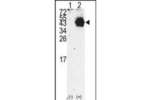 Western blot analysis of PDX1 (arrow) using rabbit polyclonal PDX1 Antibody (N-term) (R). (PDX1 抗体  (N-Term))