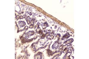 IHC analysis of Ribonuclease 3 using anti-Ribonuclease 3 antibody (ABIN5693221). (RNASE3 抗体  (AA 28-160))