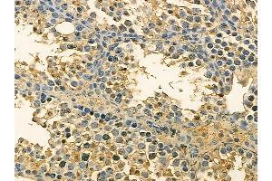 p23 Mouse Monoclonal Antibody at 1/100 staining mouse testis tissue by IHC-P. (CDK5R1 抗体)