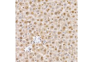 Immunohistochemistry (IHC) image for anti-Solute Carrier Family 14 (Urea Transporter), Member 1 (Kidd Blood Group) (SLC14A1) (C-Term) antibody (ABIN7270402)
