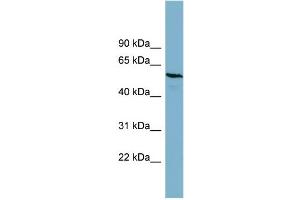 WB Suggested Anti-PGM3  Antibody Titration: 0. (Phosphoglucomutase 3 抗体  (Middle Region))