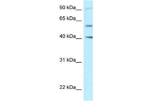 WB Suggested Anti-SHCBP1L Antibody Titration: 1. (SHCBP1L 抗体  (C-Term))