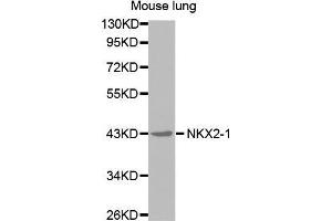 Western Blotting (WB) image for anti-NK2 Homeobox 1 (NKX2-1) antibody (ABIN1681058) (NKX2-1 抗体)