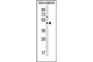 Western blot analysis of Keratocan Antibody (KERA 抗体  (C-Term))