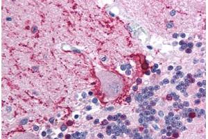 Human Brain, Cerebellum (formalin-fixed, paraffin-embedded) stained with TRIM31 antibody ABIN213720 at 2. (TRIM31 抗体  (AA 117-166))