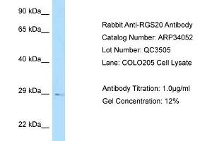 WB Suggested Anti-RGS20 Antibody   Titration: 1. (RGS20 抗体  (N-Term))