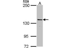 WB Image Sample (30 ug of whole cell lysate) A: MCF-7 5% SDS PAGE antibody diluted at 1:1000 (POLG 抗体  (C-Term))