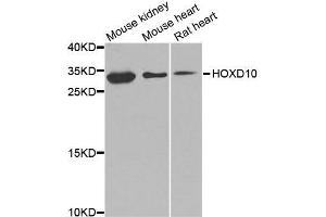 Western blot analysis of extracts of various cell lines, using HOXD10 antibody (ABIN5974761) at 1/1000 dilution. (HOXD10 抗体)