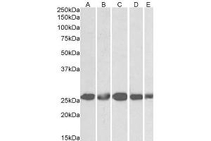 ABIN5539633 (1µg/ml) staining of NIH3T3 (A), HeLa (B), K562 (C), MCF7 (D) and HepG2 (E) lysates (35µg protein in RIPA buffer). (CSNK2B 抗体  (Internal Region))