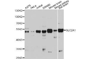 Western blot analysis of extracts of various cell lines, using SLC2A1 antibody (ABIN5975456) at 1/1000 dilution. (GLUT1 抗体)