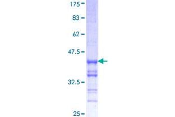 RNF2 Protein (AA 192-290) (GST tag)