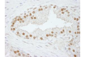 Immunohistochemistry (IHC) image for anti-Cleavage and Polyadenylation Specific Factor 3, 73kDa (CPSF3) (AA 634-684) antibody (ABIN7448486)