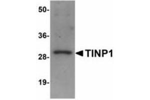 Image no. 1 for anti-NSA2 Ribosome Biogenesis Homolog (NSA2) (C-Term) antibody (ABIN478277) (NSA2 抗体  (C-Term))