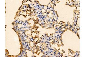 ABIN7094696 and ABIN7098747 at 1/100 staining Mouse lung tissue by IHC-P. (PFDN6 抗体  (N-Term))