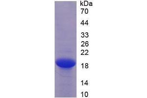 Image no. 1 for Endothelial Cell-Specific Molecule 1 (ESM1) (AA 20-184) (Active) protein (His tag) (ABIN6239900)
