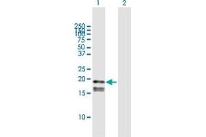 Western Blot analysis of GP9 expression in transfected 293T cell line by GP9 MaxPab polyclonal antibody. (CD42a 抗体  (AA 1-177))