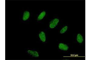 Immunofluorescence of purified MaxPab antibody to FLJ38288 on HeLa cell. (ZNF776 抗体  (AA 1-476))