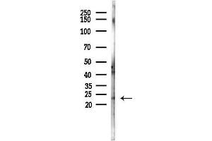 Western blot analysis of lysates from HepG2 cells(starvation,24h treatment), using Phospho-SNAP23 (Ser95) Antibody at 1/1000 dilution.