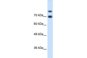 Western Blotting (WB) image for anti-Homeodomain Interacting Protein Kinase 2 (HIPK2) antibody (ABIN2460508) (HIPK2 抗体)