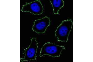 Fluorescent image of A549 cell stained with CD33 Antibody (ABIN1540002 and ABIN2843889)/SM120504AC. (CD33 抗体  (AA 337-364))