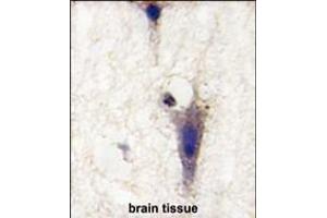 Immunohistochemistry (Paraffin-embedded Sections) (IHC (p)) image for anti-Leucine Rich Repeat and Ig Domain Containing 1 (LINGO1) (AA 62-92), (N-Term) antibody (ABIN391440)