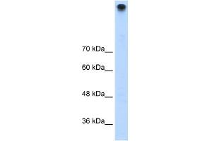 Western Blotting (WB) image for anti-Transient Receptor Potential Cation Channel, Subfamily M, Member 3 (TRPM3) (N-Term) antibody (ABIN630116)