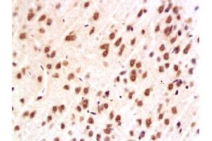 Formalin-fixed and paraffin embedded rat hippocampus labeled with Anti-ERK2/MAPK1 Polyclonal Antibody, Unconjugated (ABIN723725) at 1:200, followed by conjugation to the secondary antibody and DAB staining (ERK1/2 抗体  (AA 301-358))