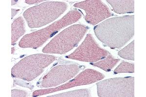 Immunohistochemistry (IHC) image for anti-Transient Receptor Potential Cation Channel, Subfamily A, Member 1 (TRPA1) (N-Term) antibody (ABIN1104836)