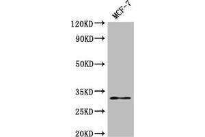 Western Blot Positive WB detected in: MCF-7 whole cell lysate All lanes: RSPH9 antibody at 1:2000 Secondary Goat polyclonal to rabbit IgG at 1/50000 dilution Predicted band size: 32, 35 kDa Observed band size: 32 kDa (RSPH9 抗体  (AA 62-171))