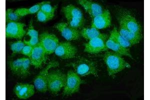 IF analysis of MTTP using anti-MTTP antibody (ABIN7601145). (MTTP 抗体  (AA 29-702))
