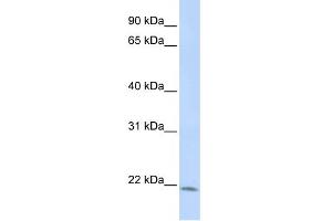 WB Suggested Anti-LIN7C Antibody Titration:  1 ug/ml  Positive Control:  HepG2 cell lysate (LIN7C 抗体  (N-Term))