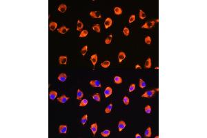 Immunofluorescence analysis of L929 cells using KIF21A Rabbit pAb (ABIN7268127) at dilution of 1:100. (KIF21A 抗体  (AA 1070-1270))