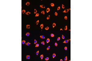 Immunofluorescence analysis of L929 cells using KIF21A Rabbit pAb (ABIN7268127) at dilution of 1:100. (KIF21A 抗体  (AA 1070-1270))